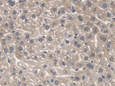 Serine Palmitoyltransferase, Long Chain Base Subunit 1 (SPTLC1) Polyclonal Antibody - image 5