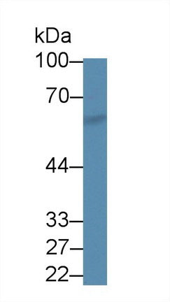 Western Blot; Sample: Recombinant protein.