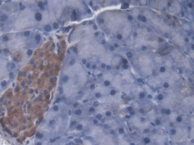 Serine Palmitoyltransferase, Long Chain Base Subunit 2 (SPTLC2) Polyclonal Antibody - image 4