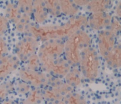 Serine Palmitoyltransferase, Long Chain Base Subunit 3 (SPTLC3) Polyclonal Antibody - image 4