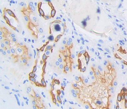 Serine Palmitoyltransferase, Long Chain Base Subunit 3 (SPTLC3) Polyclonal Antibody - image 3