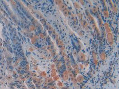 Transcription Factor A, Mitochondrial (TFAM) Polyclonal Antibody - image 5