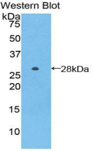 Transforming Growth Factor Beta 1 Induced Transcript 1 (TGFb1I1) Polyclonal Antibody - image 2