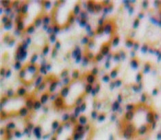 Transforming Growth Factor Beta 1 Induced Transcript 1 (TGFb1I1) Polyclonal Antibody - image 3