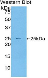 Toll Like Receptor Adaptor Molecule 2 (TICAM2) Polyclonal Antibody - image 2