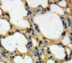 Toll Like Receptor Adaptor Molecule 2 (TICAM2) Polyclonal Antibody - image 3