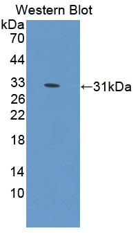 Tumor Protein p53 Binding Protein 1 (TP53BP1) Polyclonal Antibody - image 2
