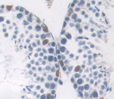 Tumor Protein p53 Binding Protein 1 (TP53BP1) Polyclonal Antibody - image 3