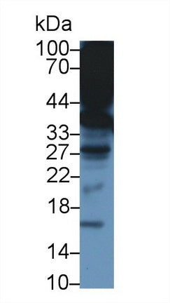 Western Blot; Sample: Recombinant protein.