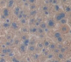 Alpha-Tocopherol Transfer Protein (TTPa) Polyclonal Antibody - image 4