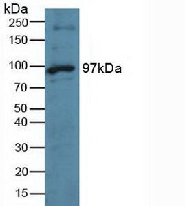 Knockout Varification: ; Lane 1: Wild-type Hela cell lysate; ; Lane 2: TTK knockout Hela cell lysate; ; Predicted MW: 97kd ; Observed MW: 100kd; Primary Ab: 5µg/ml Rabbit Anti-Human TTK Antibody; Second Ab: 0.2µg/mL HRP-Linked Caprine Anti-Rabbit IgG Polyclonal Antibody;