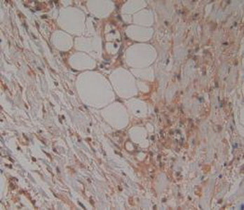 TTK Protein Kinase (TTK) Polyclonal Antibody - image 5