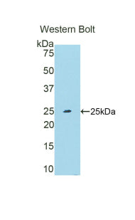 Ubiquitin Carboxyl Terminal Hydrolase L5 (UCHL5) Polyclonal Antibody - image 2