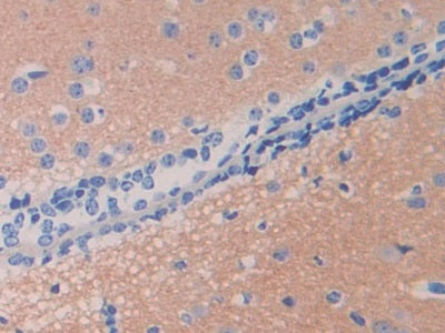 Ubiquitin Carboxyl Terminal Hydrolase L5 (UCHL5) Polyclonal Antibody - image 4