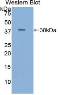 Used in DAB staining on fromalin fixed paraffin-embedded Kidney tissue