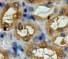 Ubiquitin Carboxyl Terminal Hydrolase L5 (UCHL5) Polyclonal Antibody - image 4