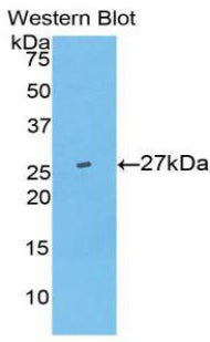 Ubiquitin Carboxyl Terminal Hydrolase L5 (UCHL5) Polyclonal Antibody - image 2