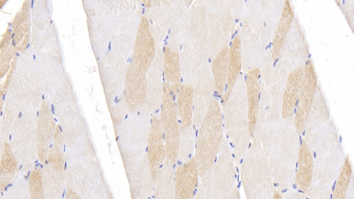 Ubiquitin Carboxyl Terminal Hydrolase L5 (UCHL5) Polyclonal Antibody - image 3