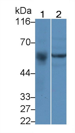 UDP Glucuronosyltransferase 2 Family, Polypeptide B7 (UGT2B7) Polyclonal Antibody - image 2