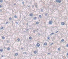 Voltage Dependent Anion Channel Protein 1 (VDAC1) Polyclonal Antibody - image 3