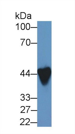 Western Blot; Sample: Recombinant protein.
