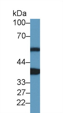 Western Blot; Sample: Recombinant protein.