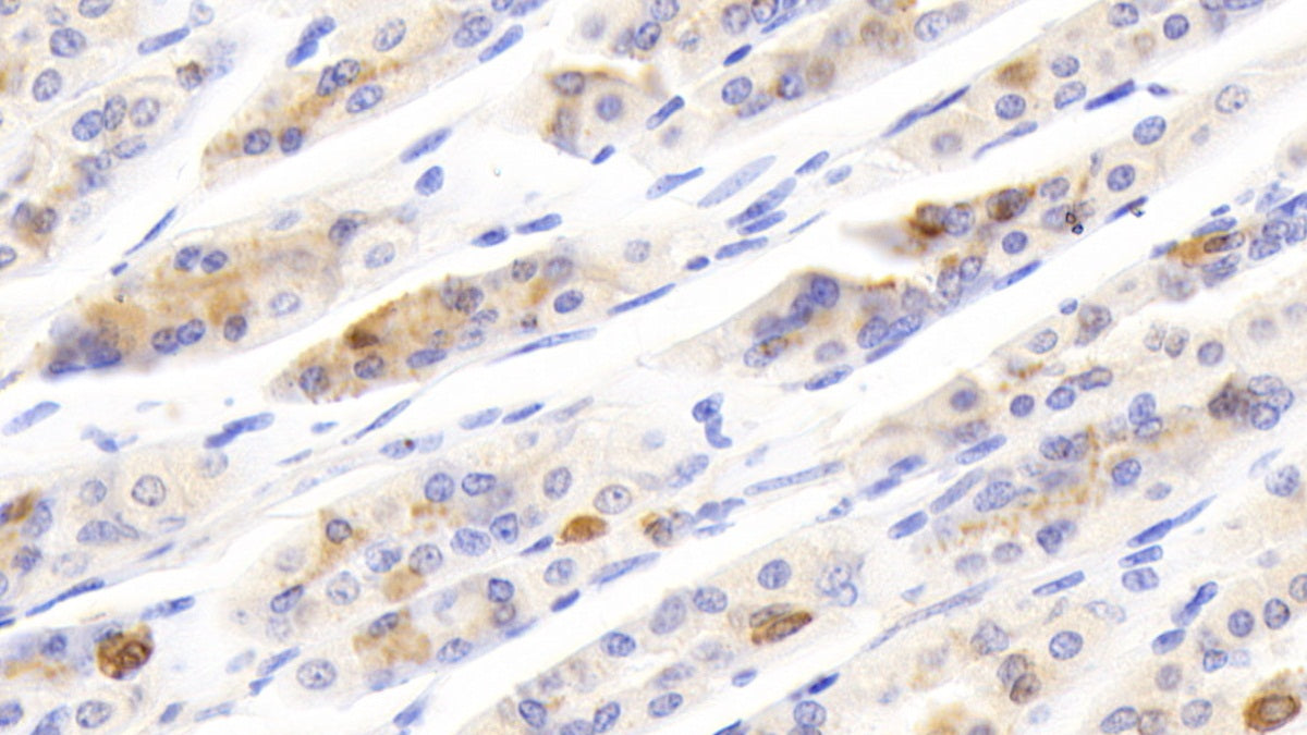 DAB staining on IHC-P; Samples: Mouse Brain Tissue