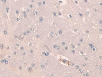 Secretagogin (SCGN) Polyclonal Antibody - image 5