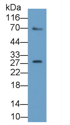 Spermidine/Spermine N1-Acetyltransferase 1 (SAT1) Polyclonal Antibody - image 2