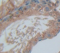 Spermidine/Spermine N1-Acetyltransferase 1 (SAT1) Polyclonal Antibody - image 3