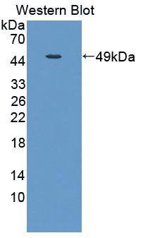 DAB staining on IHC-P; Samples: Rat Skeletal muscle Tissue;  Primary Ab: 20μg/ml Rabbit Anti-Rat TCN2 Antibody Second Ab: 2µg/mL HRP-Linked Caprine Anti-Rabbit IgG Polyclonal Antibody