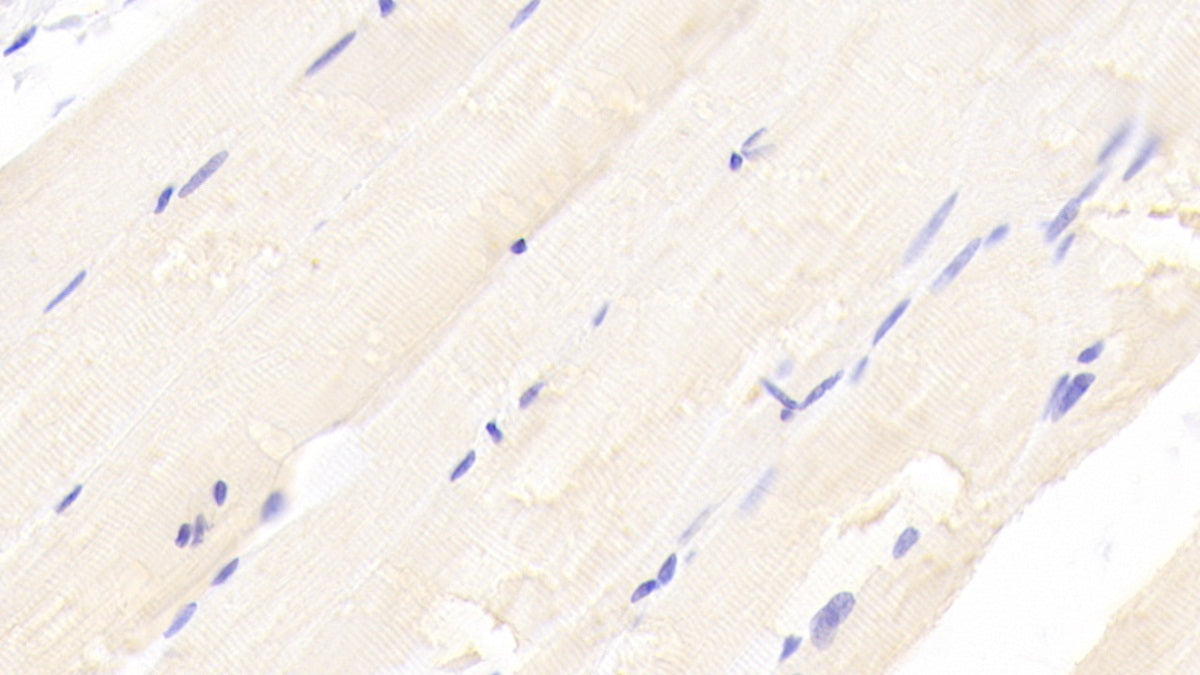 Transcobalamin II, Macrocytic Anemia (TCN2) Polyclonal Antibody - image 4