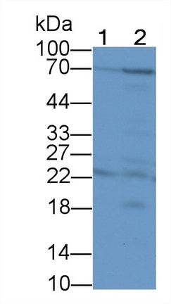 Transcobalamin I (TCN1) Polyclonal Antibody - image 3