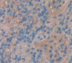 Transcobalamin I (TCN1) Polyclonal Antibody - image 4
