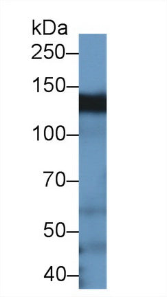 Western Blot; Sample: Recombinant protein.