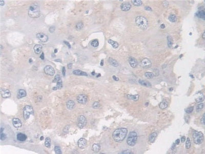 DAB staining on fromalin fixed paraffin- embedded lung tissue)
