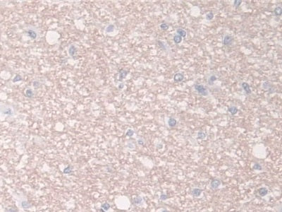 Breast Cancer Anti-Estrogen Resistance 1 (BCAR1) Polyclonal Antibody - image 5