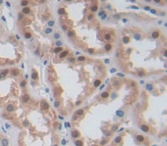 RNA Binding Motif Protein 38 (RBM38) Polyclonal Antibody - image 3