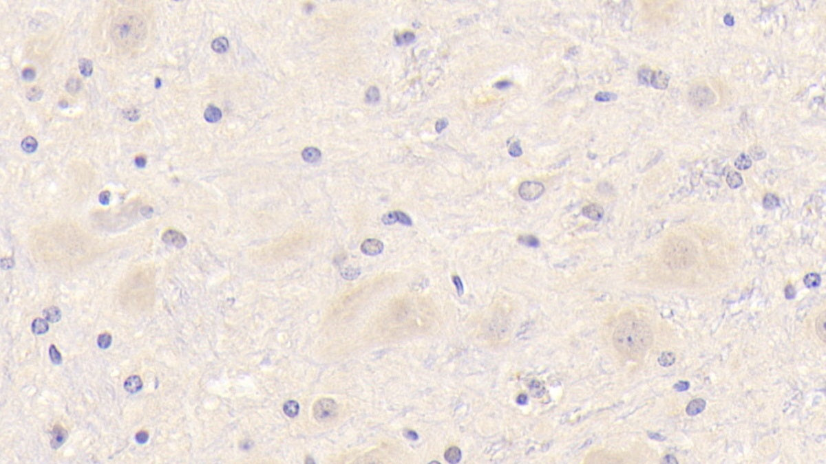 Triggering Receptor Expressed On Myeloid Cells 2 (TREM2) Polyclonal Antibody - image 4