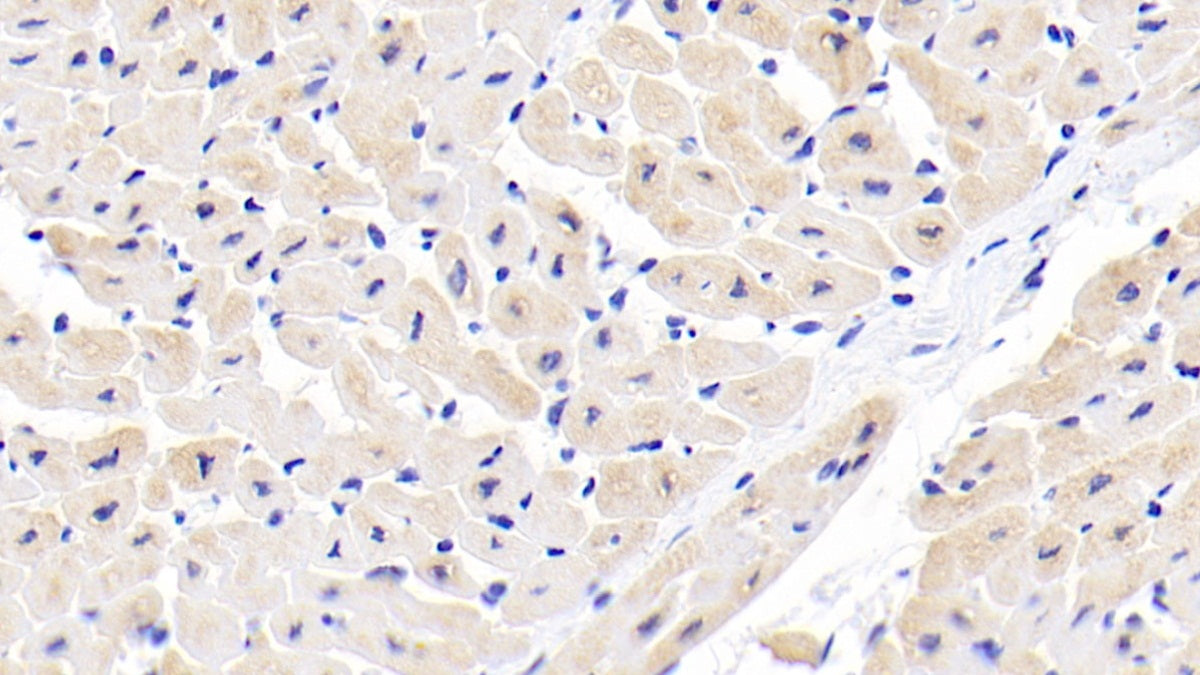 Arylsulfatase B (ARSB) Polyclonal Antibody - image 4