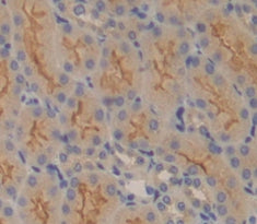 Solute Carrier Family 30, Member 6 (SLC30A6) Polyclonal Antibody - image 3