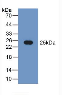 DAB staining on IHC-P; Samples: Human Liver Tissue; Primary Ab: 10µg/ml Rabbit Anti-Human PEBP1 Antibody Second Ab: 2µg/mL HRP-Linked Caprine Anti-Rabbit IgG Polyclonal Antibody
