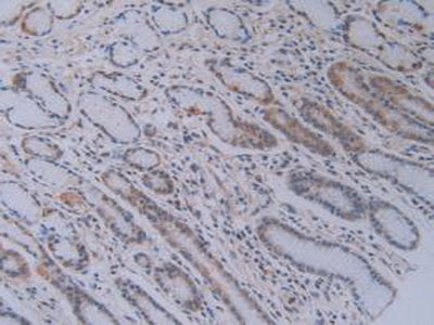 Phosphatidylethanolamine Binding Protein 1 (PEBP1) Polyclonal Antibody - image 5