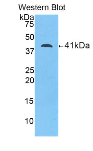 DAB staining on IHC-P; Samples: Human Kidney Tissue;  Primary Ab: 20μg/ml Rabbit Anti-Human LCN12 Antibody Second Ab: 2µg/mL HRP-Linked Caprine Anti-Rabbit IgG Polyclonal Antibody