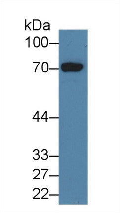 Western Blot; Sample: Recombinant protein.