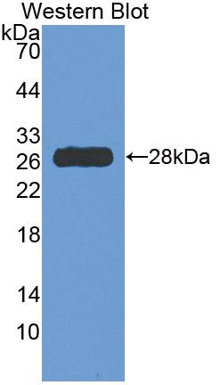 DAB staining on IHC-P; Samples: Human Liver Tissue;  Primary Ab: 10µg/ml Rabbit Anti-Human HDC Antib