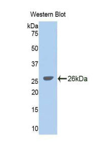 Glycine Dehydrogenase (GLDC) Polyclonal Antibody - image 2