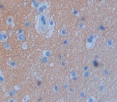 Glycine Dehydrogenase (GLDC) Polyclonal Antibody - image 3
