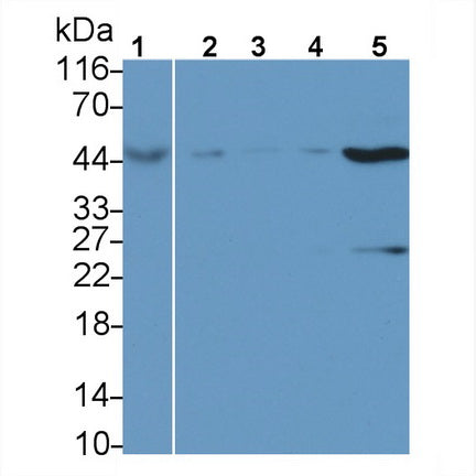 DAB staining on IHC-P; Samples: Human Kidney Tissue; Primary Ab: 10µg/ml Rabbit Anti-Human AHCY Antibody Second Ab: 2µg/mL HRP-Linked Caprine Anti-Rabbit IgG Polyclonal Antibody