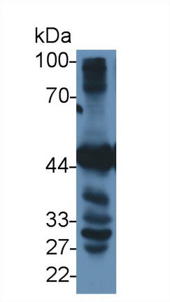 DAB staining on IHC-P; Samples: Porcine Cardiac Muscle Tissue; Primary Ab: 10µg/ml Rabbit Anti-Human BHMT Antibody Second Ab: 2µg/mL HRP-Linked Caprine Anti-Rabbit IgG Polyclonal Antibody